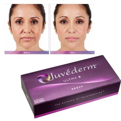 Ácido Hialurónico Juvederm Gel de Enchimento Facial Pele Suave e Incompreensível