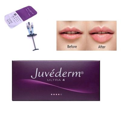 Allergan Juvederm Enchimento Dermológico Injecção Ultra4 Com Lido