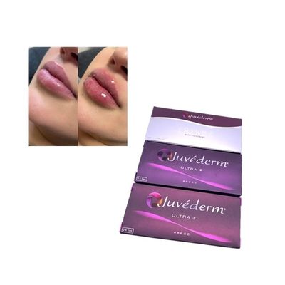 Injecção Juvederm Voluma Cross Linked Dermal Filler
