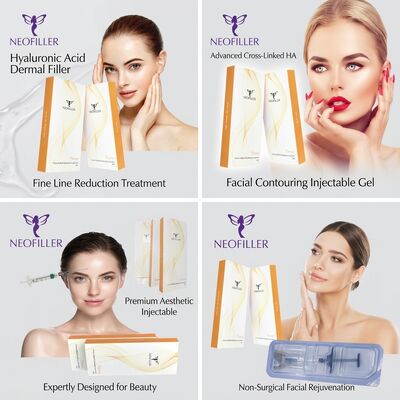 Seringa estéril de 1ml, preenchimento dérmico de ácido hialurônico, gel injetável reticulado biocompatível, prateleira de 24 meses, contorno facial