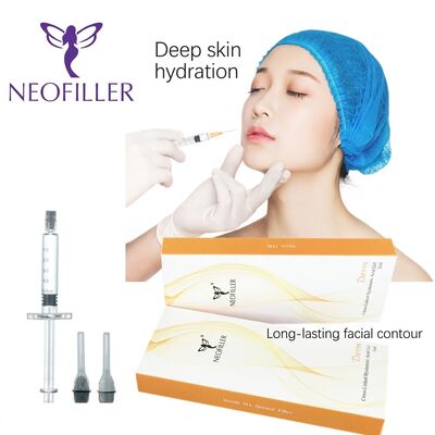 Seringa estéril de 1ml, preenchimento dérmico de ácido hialurônico, gel injetável reticulado biocompatível, prateleira de 24 meses, contorno facial