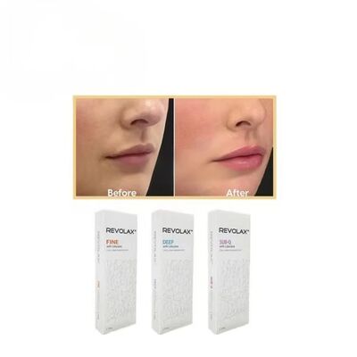Preenchimento Dermológico Revolax Sub-Q profundo e fino, com consistência de gel suave e elástico para restauração do volume facial de aparência natural