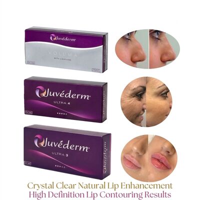 Volume da Seringa 2 1 ml por Caixa Juvederm Voluma Filler Segurança Contouring Facial Injetável Filler Dermico para aumento de volume