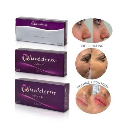 Juvederm Ultra 4 Nose Filler Ácido hialurónico Filler dérmico para não cirúrgico Rhinoplasty Reshaping nariz