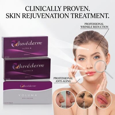 Preenchedor Juvederm Ultra 3 para Sulcos Nasogenianos Ácido Hialurônico Preenchedor Dérmico para Suavizar Linhas de Expressão 24mg/ml
