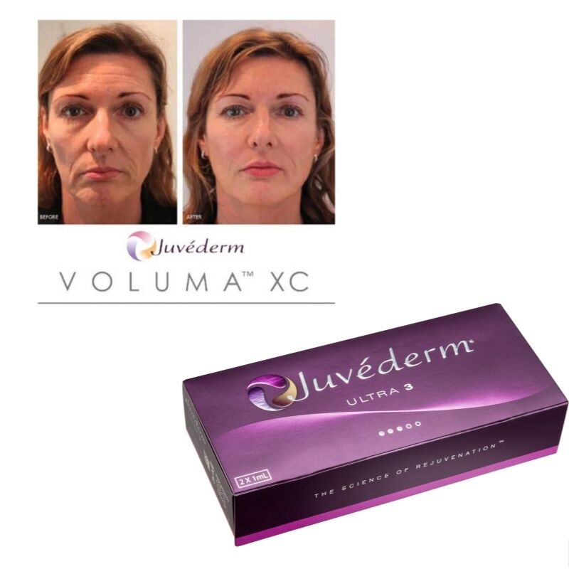 Correção de rugas Juvederm Preenchimento dérmico Ácido hialurónico Gel injetável Tratamento suavizante de longa duração