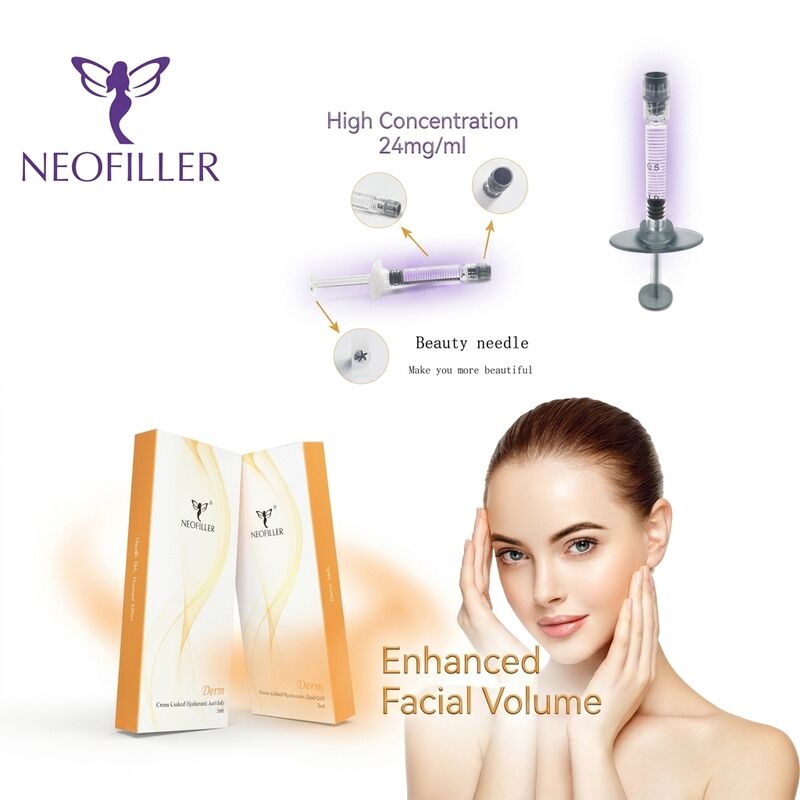Seringa estéril de 1ml, preenchimento dérmico de ácido hialurônico, gel injetável reticulado biocompatível, prateleira de 24 meses, contorno facial