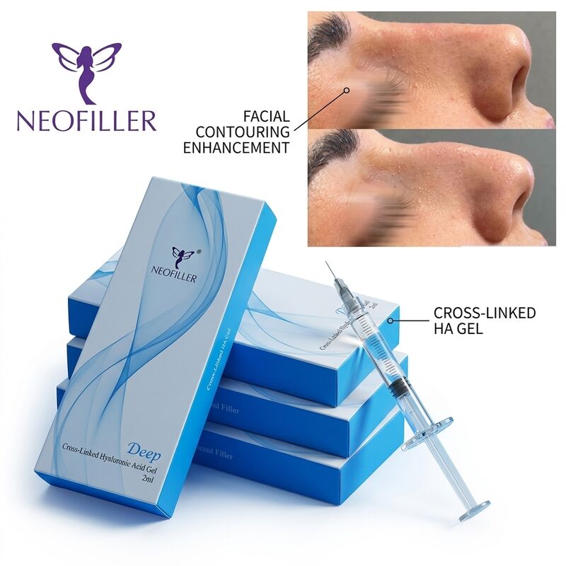 Ácido hialurônico anti-rugas de linha profunda, preenchimento cutâneo, gel injetável, aumento do volume facial
