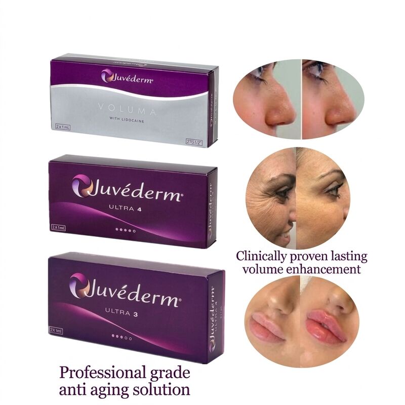 Cirurgia Plástica Juvederm Dermal Filler Concentração 20mgMl Longevidade 9-12 meses Adequado para melhorar o contorno facial e rejuvenescimento da pele