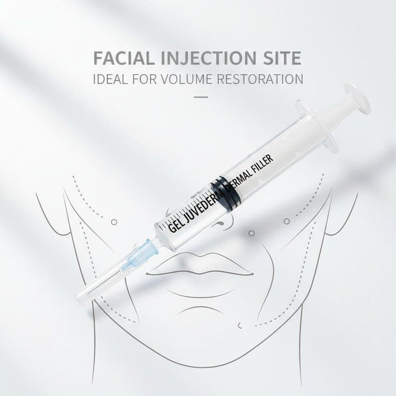 Gel Juvederm Dermal Filler 1 ml Seringa Local de injecção facial Ideal para procedimentos de rejuvenescimento facial e restauração do volume